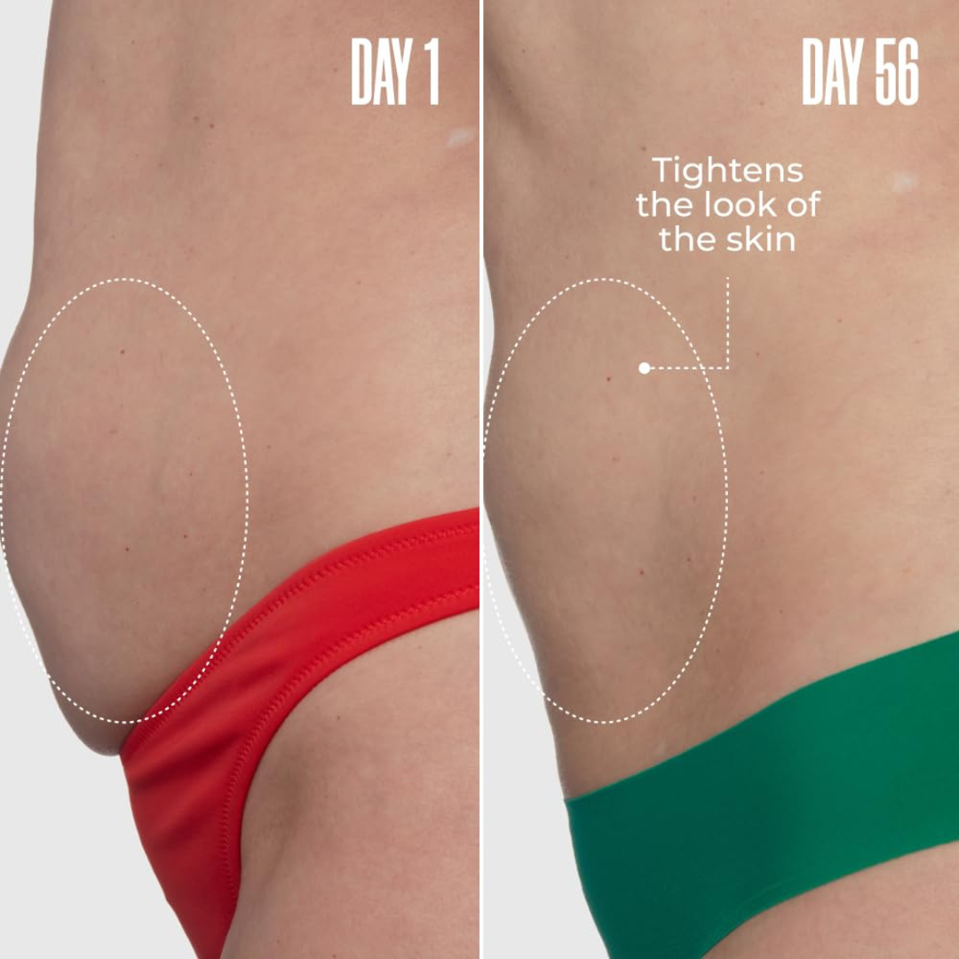Eluvia™ Toning Whip
