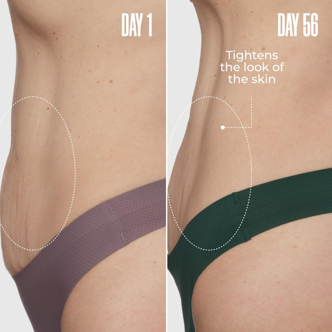 Eluvia™ Toning Whip