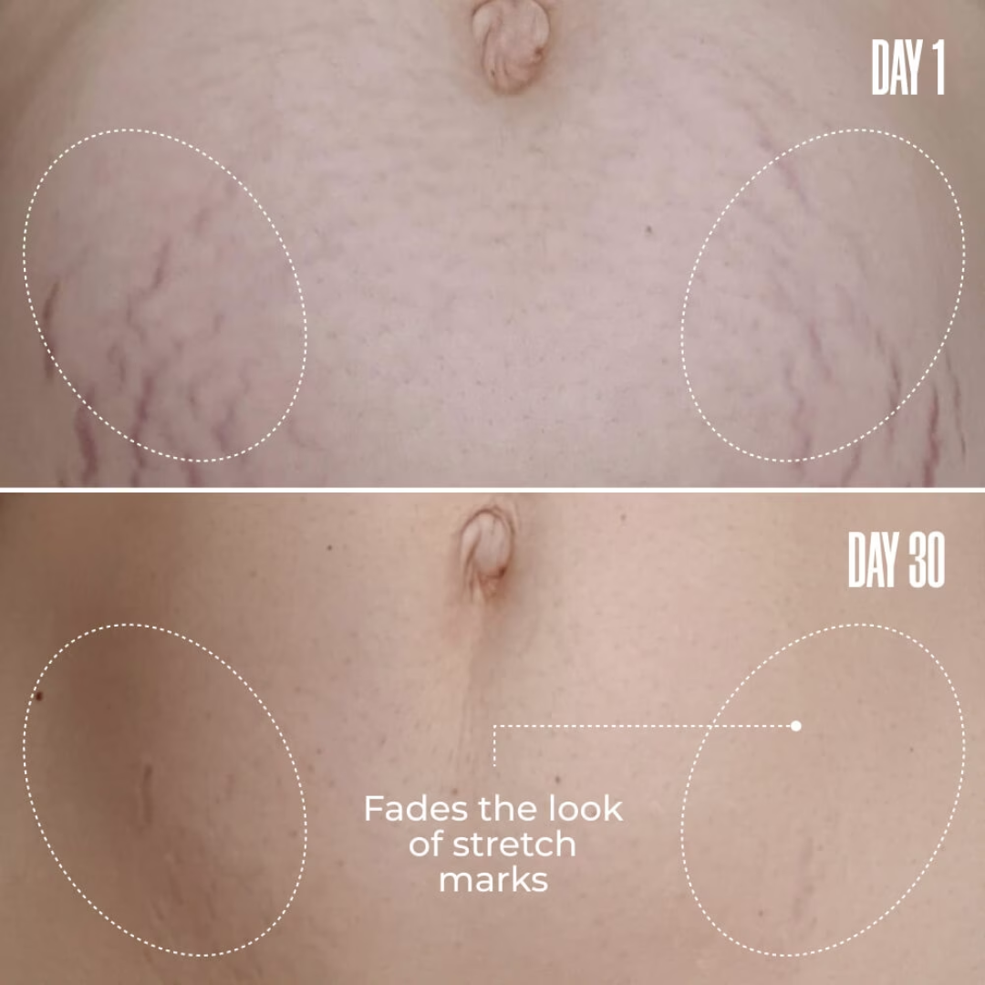 Eluvia™ Firming Cream