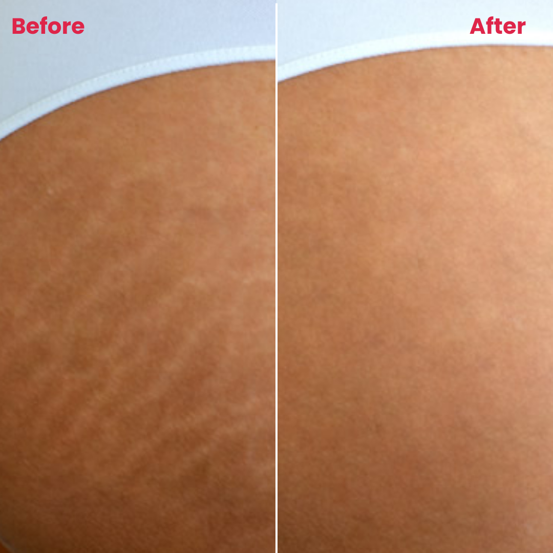 S-Resilience Serum