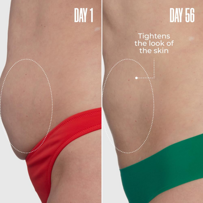 Eluvia™ Toning Whip