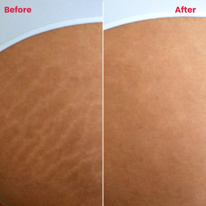 S-Resilience Serum